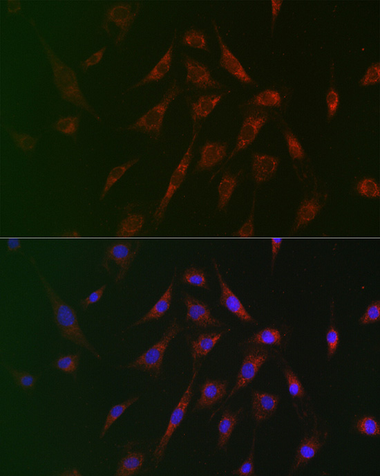 Anti-TSC2 Antibody (CAB0492)