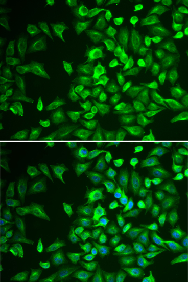 Anti-LRAT Antibody (CAB6647)