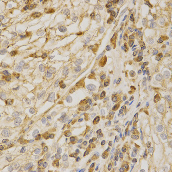 Anti-Bak Antibody (CAB13281)