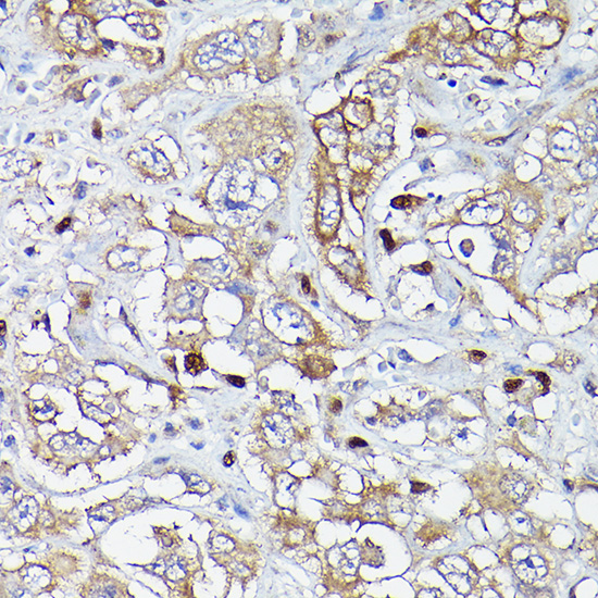 Anti-MLKL Antibody (CAB17312)