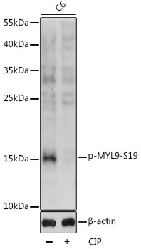 Anti-Phospho-MYL9-S19 pAb (CABP0872)