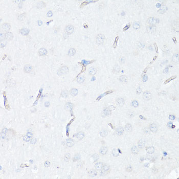 Anti-P Glycoprotein Antibody (CAB11758)