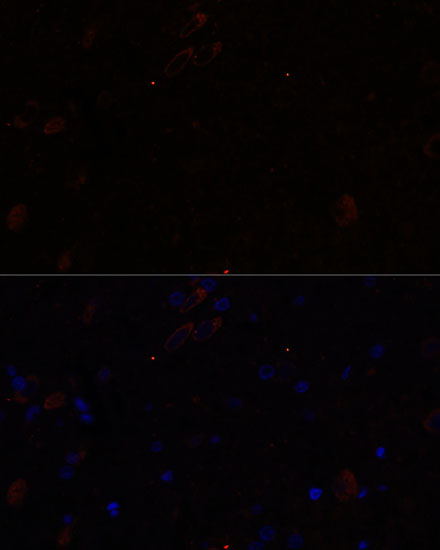 Anti-KIF17 Antibody (CAB16562)