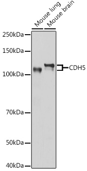 Anti-CDH5 Antibody (CAB12416)