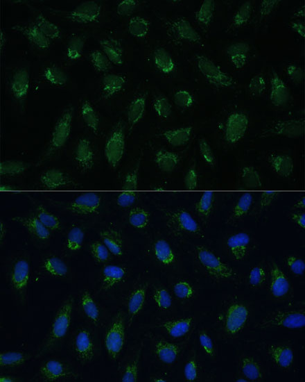 Anti-PHB2 Antibody (CAB4504)