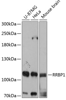 Anti-RRBP1 Antibody (CAB12239)