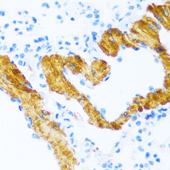 Anti-ATP2A2 / SERCA2 Antibody (CAB0098)