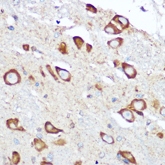 Anti-RPS6 Antibody (CAB6058)