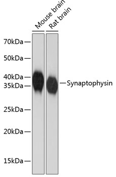 Anti-Synaptophysin Antibody (CAB19122)