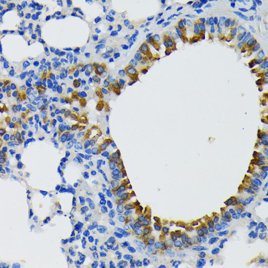 Anti-IQGAP1 Antibody (CAB5679)