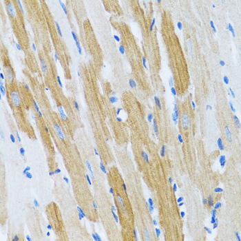 Anti-WFDC2 Antibody (CAB6788)