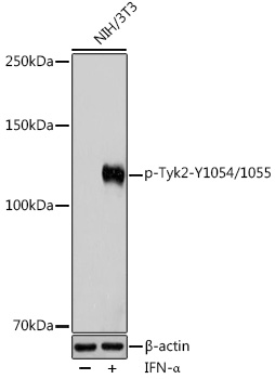 Anti-Phospho-Tyk2-Y1054/1055 Antibody (CABP0543)