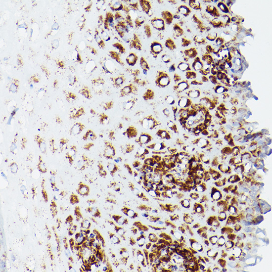 Anti-DLD Antibody (CAB5403)