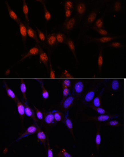 Anti-KAT6A Antibody (CAB15006)