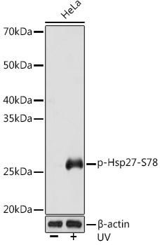 Anti-Phospho-Hsp27-S78 Antibody (CABP1032)