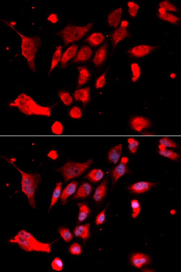 Anti-MAD2L1 Antibody (CAB1699)