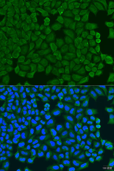 Anti-KCTD15 Polyclonal Antibody (CAB8256)