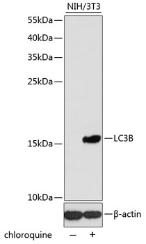 Anti-LC3B Antibody (CAB5601)