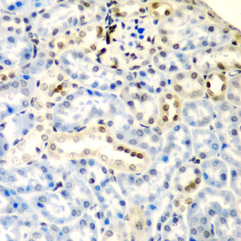 Anti-DCTD Antibody (CAB5889)