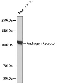 Anti-Androgen Receptor Antibody (CAB19611)