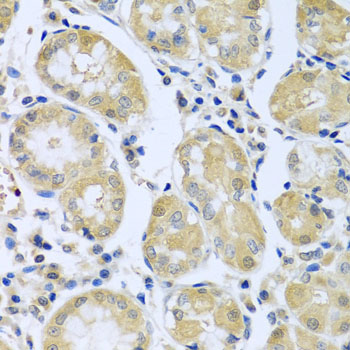 Anti-FBXL5 Antibody (CAB5602)