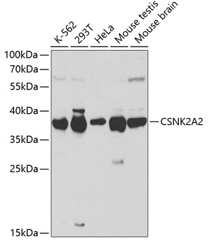 Anti-CSNK2A2 Antibody (CAB1616)