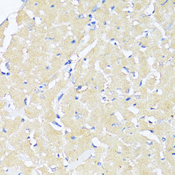 Anti-TGFB2 Antibody (CAB16226)