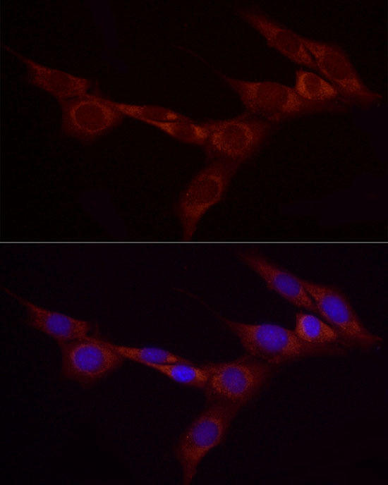 Immunofluorescence analysis of NIH/3T3 cells using Bcdin3d Rabbit pAb at dilution of 1:25 (40x lens). Blue: DAPI for nuclear staining.
