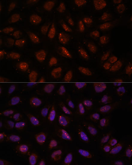 Anti-DDX24 Antibody (CAB15481)