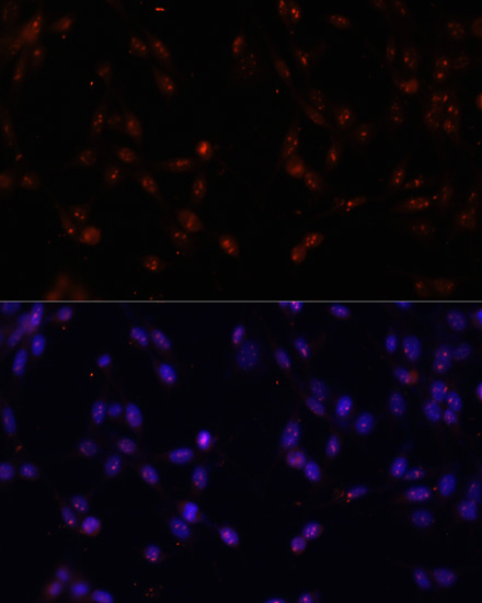 Anti-ILF3 Antibody (CAB2496)