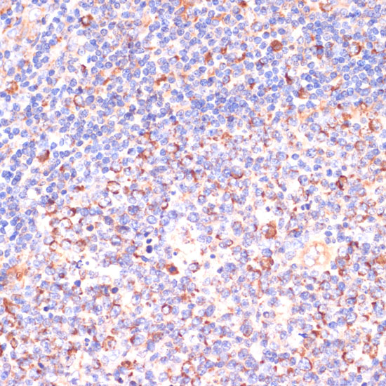 Anti-VHL Antibody (CAB0377)