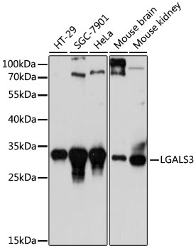 Anti-LGALS3 Antibody [KO Validated] (CAB13506)