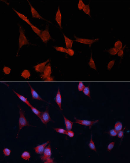 Anti-DDAH1 Antibody (CAB10295)