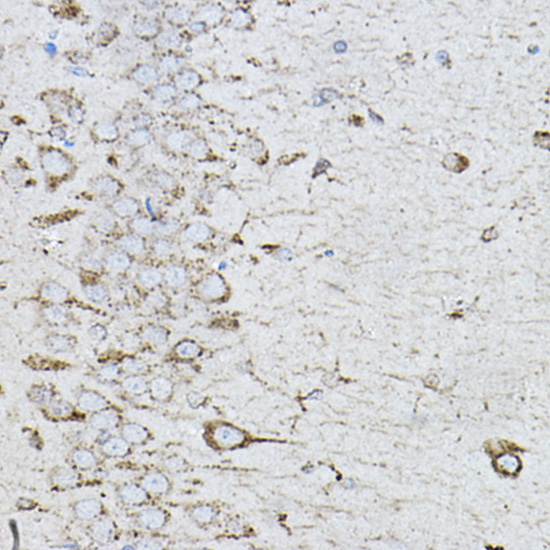 Anti-CTSD Antibody (CAB13292)