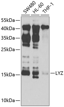 Anti-LYZ Antibody (CAB2503)