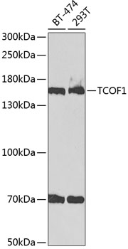 Anti-TCOF1 Antibody (CAB2512)