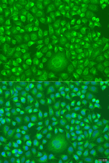 Anti-IFNW1 Antibody (CAB15067)