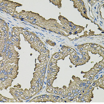 Anti-SMN2 Antibody (CAB12508)