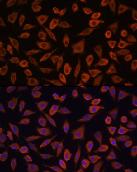 Anti-TSLP Antibody (CAB13134)