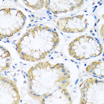 Anti-PCDHA12 Polyclonal Antibody (CAB8501)