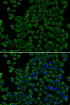 Anti-TCN2 Antibody (CAB5755)