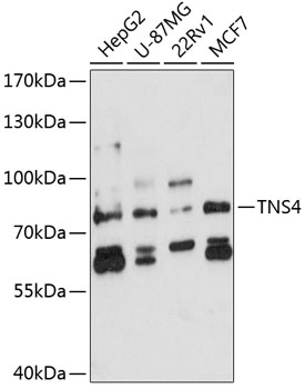 Anti-Tensin-4 Polyclonal Antibody (CAB8731)