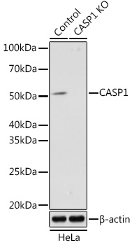 Anti-CASP1 Antibody [KO Validated] (CAB18646)