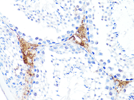 Anti-S100A10 Antibody (CAB14658)