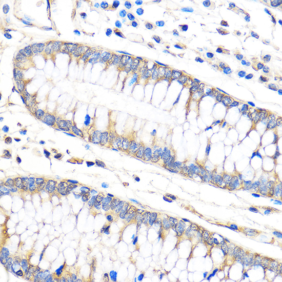 Anti-Bax Antibody (CAB15646)