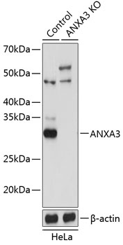 Anti-ANXA3 Antibody [KO Validated] (CAB19862)