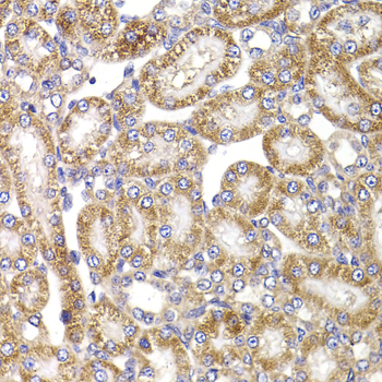 Anti-ANAPC5 Antibody (CAB7109)