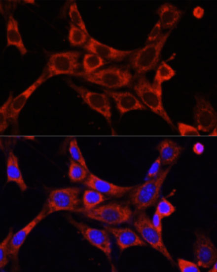 Anti-IRAK1 Antibody (CAB12624)