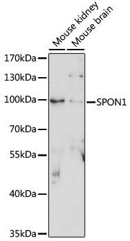 Anti-SPON1 Antibody (CAB15130)