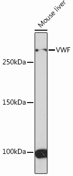 Anti-VWF Antibody